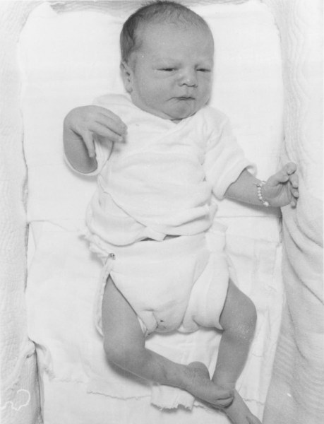 mason had thicker legshospital shot